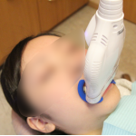 ホワイトニング専用の照射器でライトをあてます。