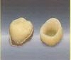 【奥歯】 CAD/CAM冠ハイブリッド